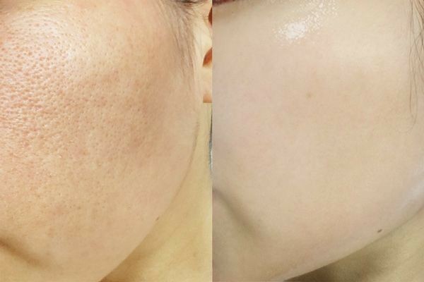 Skin Brightening Serum