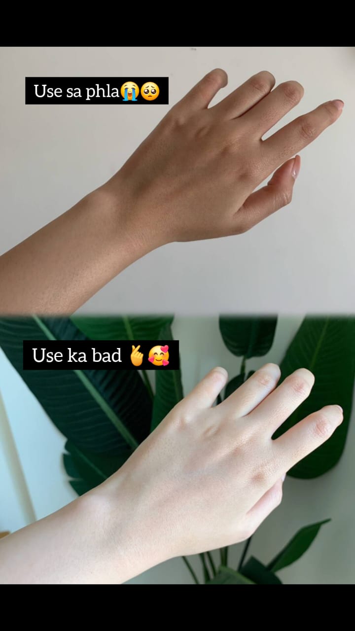 Kojic Acid Brightening Soap